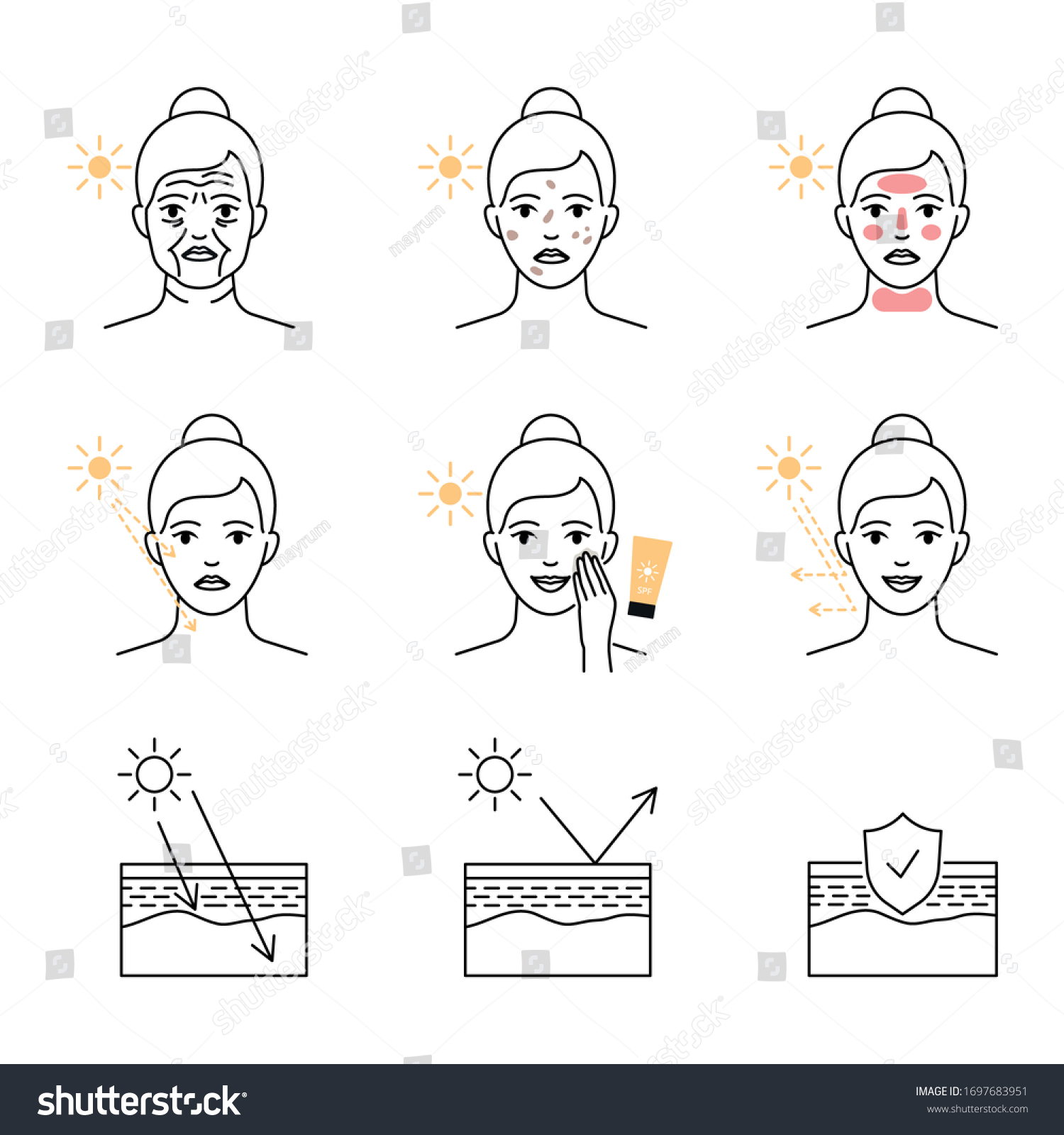 Tia UV phá hủy collagen dẫn đến lỗ chân lông mở rộng và lão hóa da