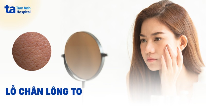 Hình ảnh lỗ chân lông to nhìn gần trên da mặt - Bệnh viện Tâm Anh