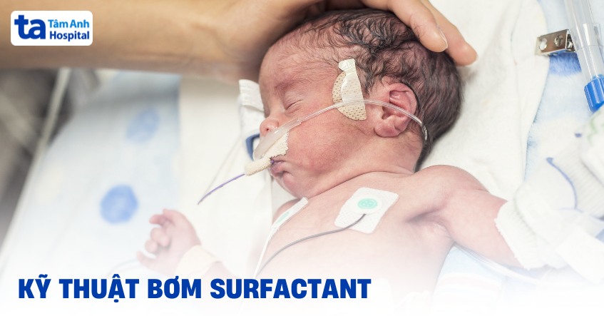 Rửa mặt đúng cách trong đủ 60 giây để surfactant hoạt động hiệu quả